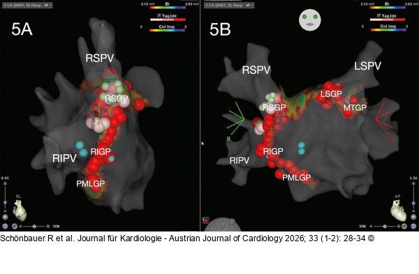 Elektroanatomisches Mapping