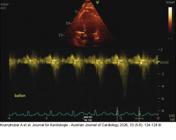 Fall 2: LVOT-Gradient