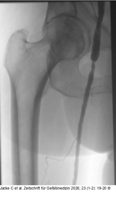 Angiographie