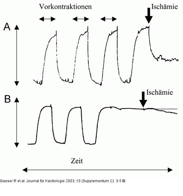 Ischämie - Vasodilatation