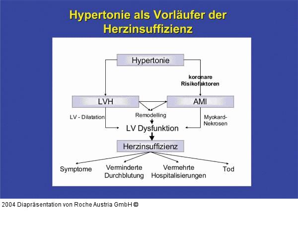 Hypertonie als Vorläufer der Herzinsuffizienz