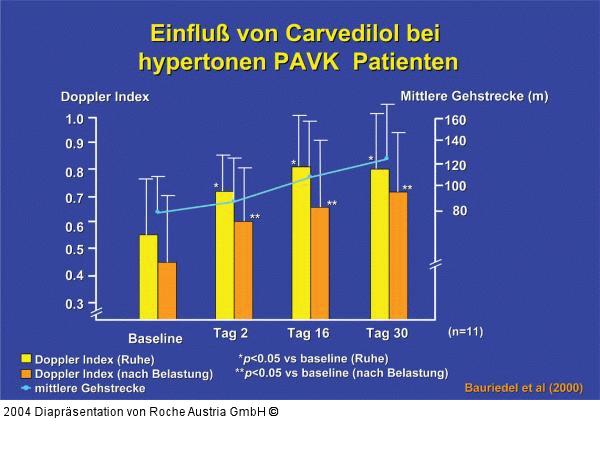 Carvedilol bei hypertonen PAVK-Patienten