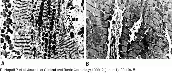 Adenosin und koronare Mikrozirkulation