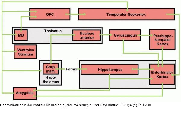 Temporallappenenzephalitis