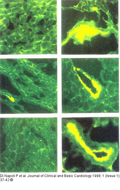 Preconditioning - koronare Mikrozirkulation