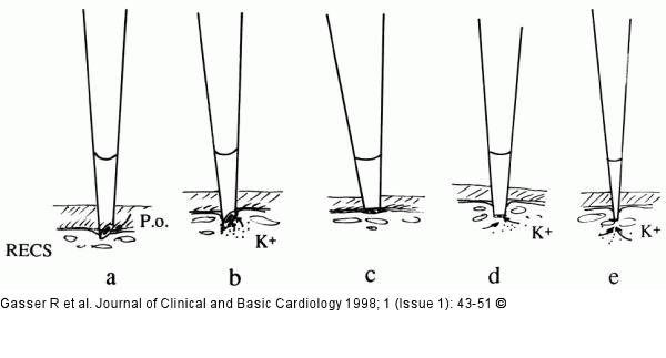 K-Efflux in Koronararterien - Mikroelektroden
