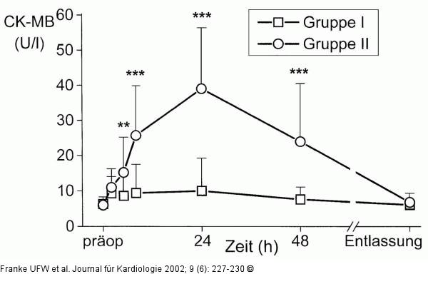 Kreatinkinase-Isoenzym - Kinetik