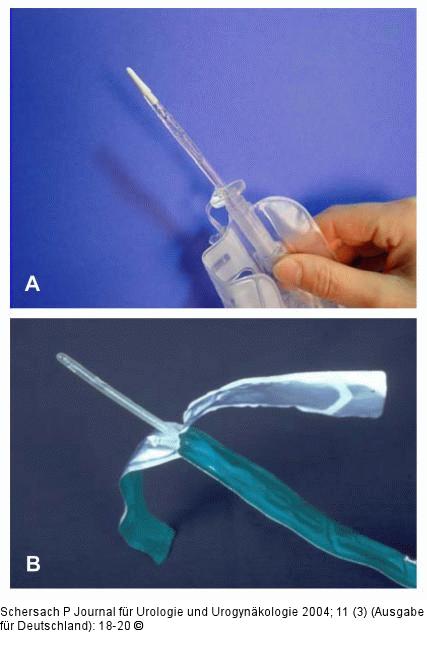 Intermittierender Selbstkatheterismus
