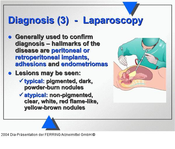 Diagnose - Laparoskopie