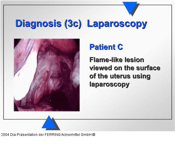 Diagnose - Laparoskopie