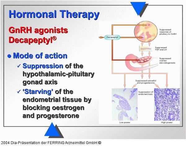 Hormonelle Therapie