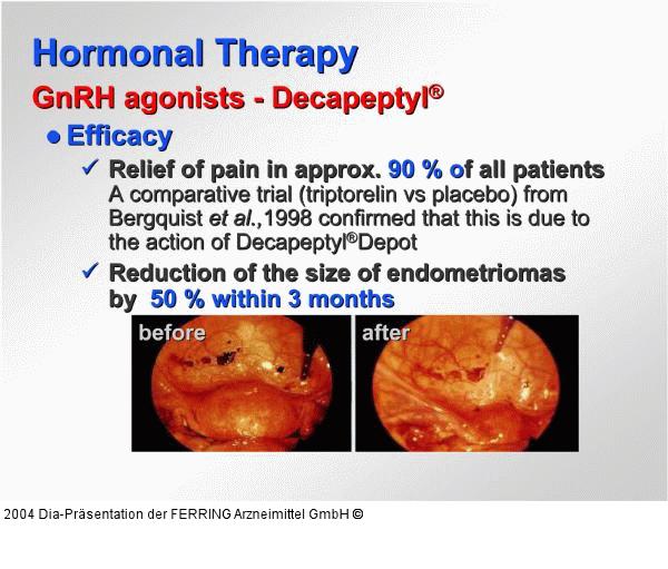 Hormonelle Therapie