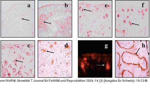 GLUT1 - GLUT3 - Immunhistochemische Färbung