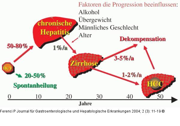 Chronische Hepatitis-C-Virusinfektion