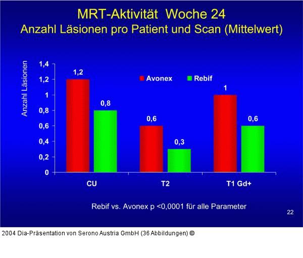 EVIDENCE  - MRT-Aktivität