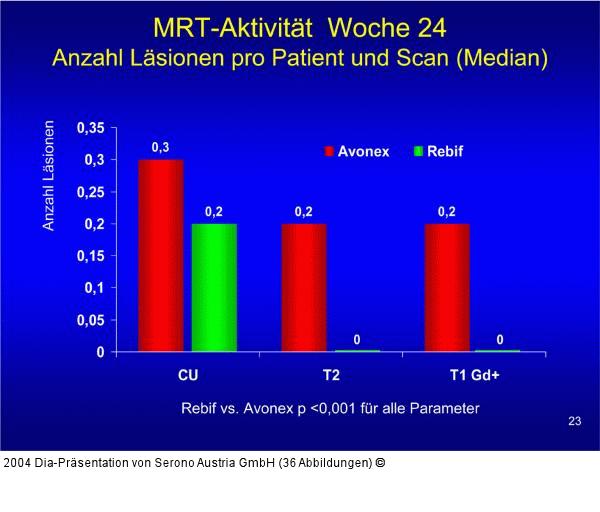 EVIDENCE - MRT-Aktivität