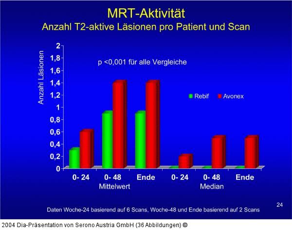 EVIDENCE - MRT-Aktivität