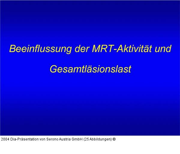 PRISMS - MRT-Aktivität