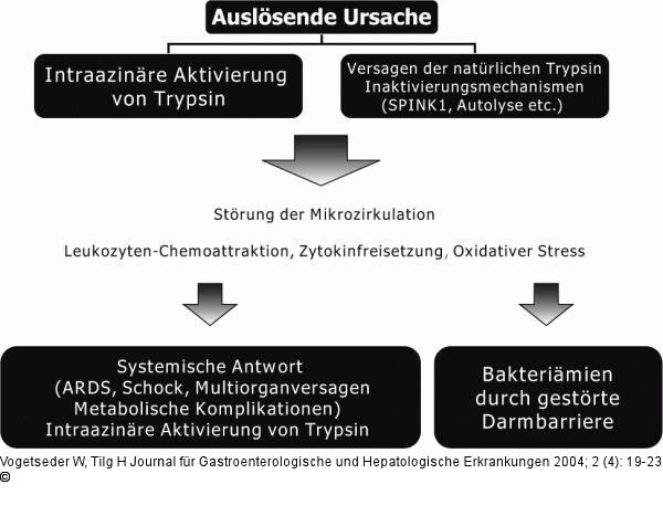 Akute Pankreatitis - Ursachen