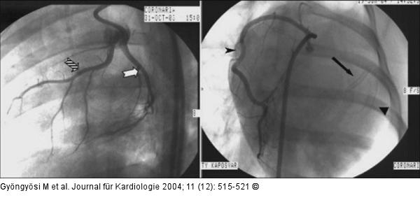 Arteria coronaria - Hausschwein