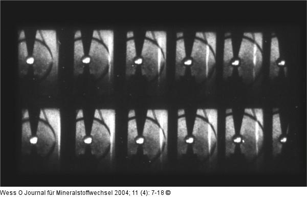 Sphärische Stoßwelle - Funkenentladung