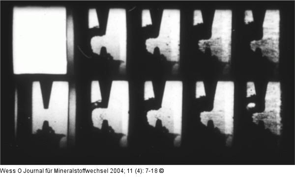 Stoßwelle - Irreguläre Funkenentladung