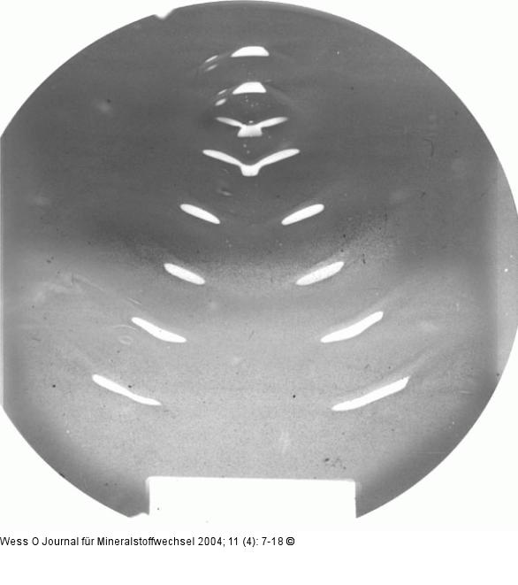 Stoßwellen - Wellenfront
