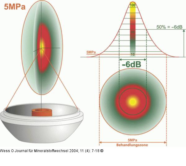 Stoßwellen - -6dB-Fokus