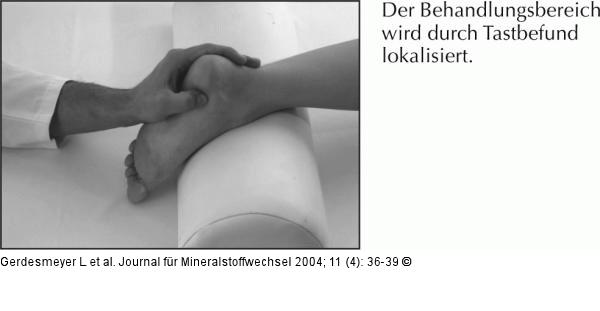 Radiale extrakorporale Stoßwellentherapie - Fersensporn