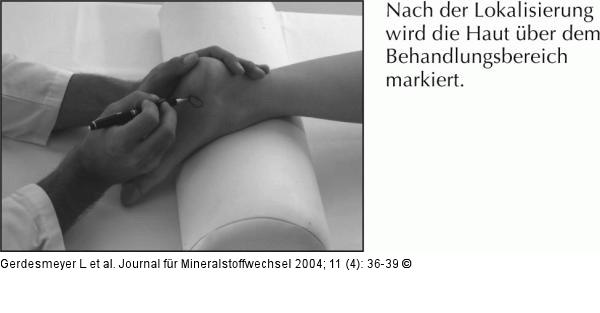 Radiale extrakorporale Stoßwellentherapie - Fersensporn