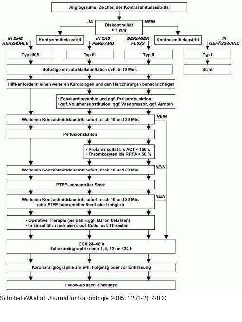 Koronare Perforation - Algorithmus