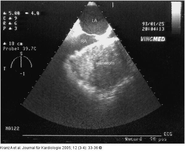 Postoperative Veränderungen