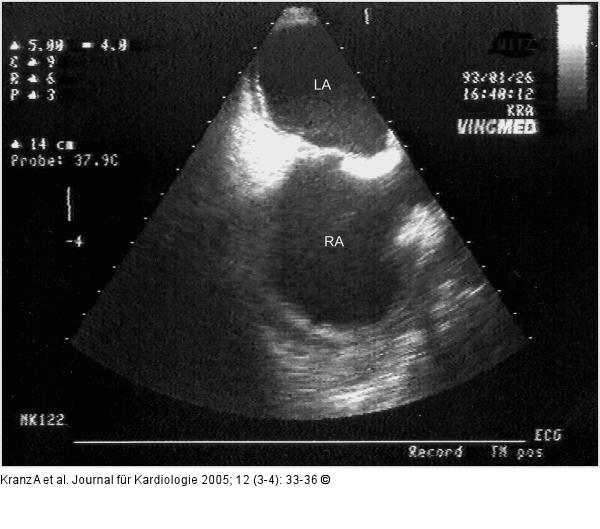 Postoperative Veränderungen