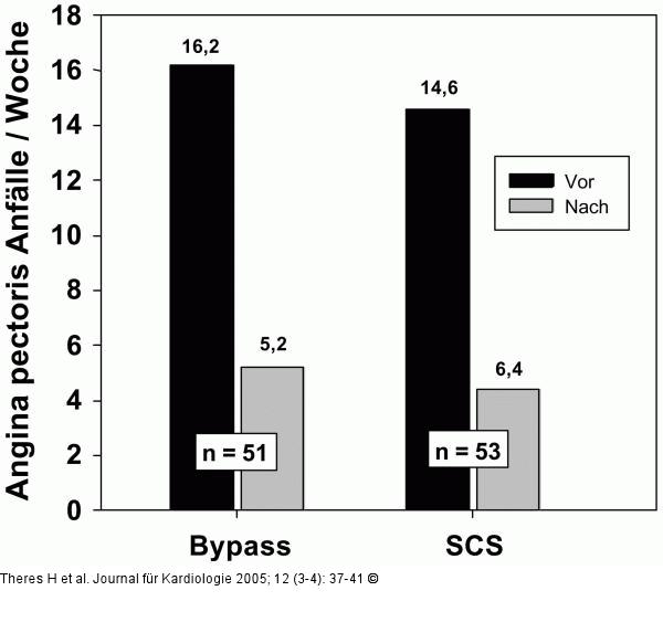 Angina pectoris - Attacken