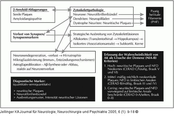 Alzheimer-Krankheit - Pathologie - Diagnostik