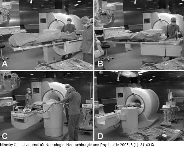 Transphenoidale Operation - Intraoperative Bildgebung