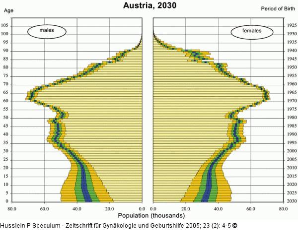 Alterspyramide Österreichs 2000