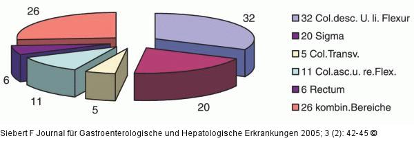 Kolon-Ischämie - Lokalisation