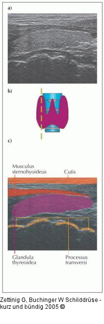 Schilddrüse - Sonographie
