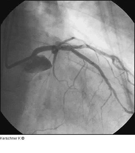 Endergebnis RAO/kranial