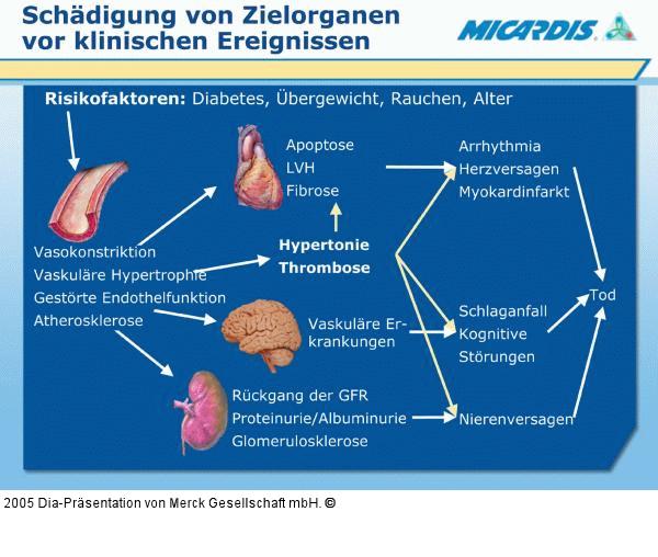 Hypertonie - Risikofaktoren - Klinische Ereignisse