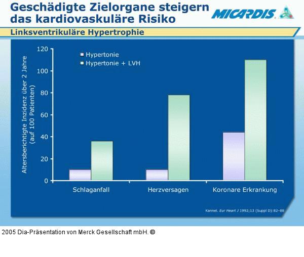 Linksventrikuläre Hypertrophie - Kardiovaskuläres Risiko