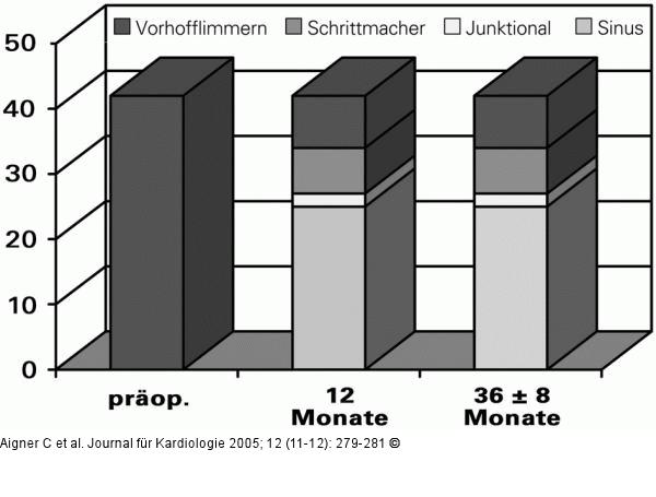 MAZE-Operation - Rhythmus