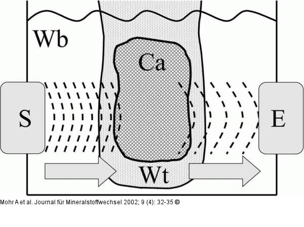 Densitometrie - Quantitativer Ultraschall