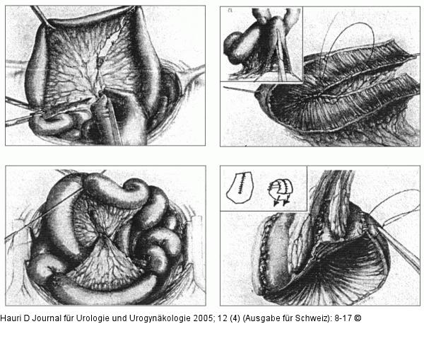 Kapazität - Compliance - Goodwin