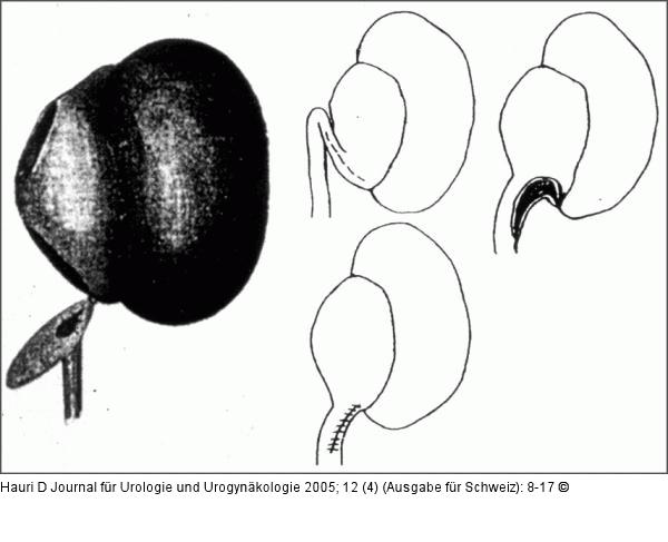 Lappenplastik - Mynter