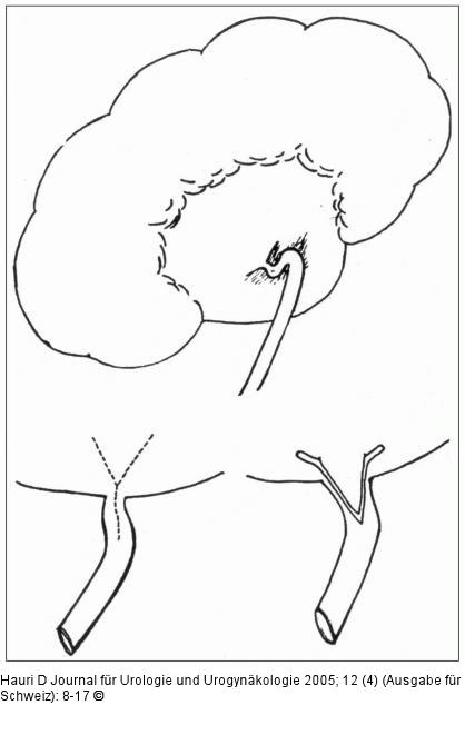 YV-Plastik - Schwyzer