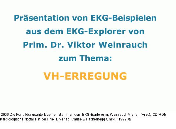 Präsentation von EKG-Beispielen