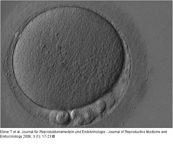 Reife Oozyte
