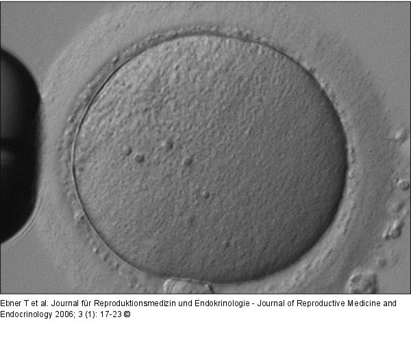 Oozyte - reifer Gamet